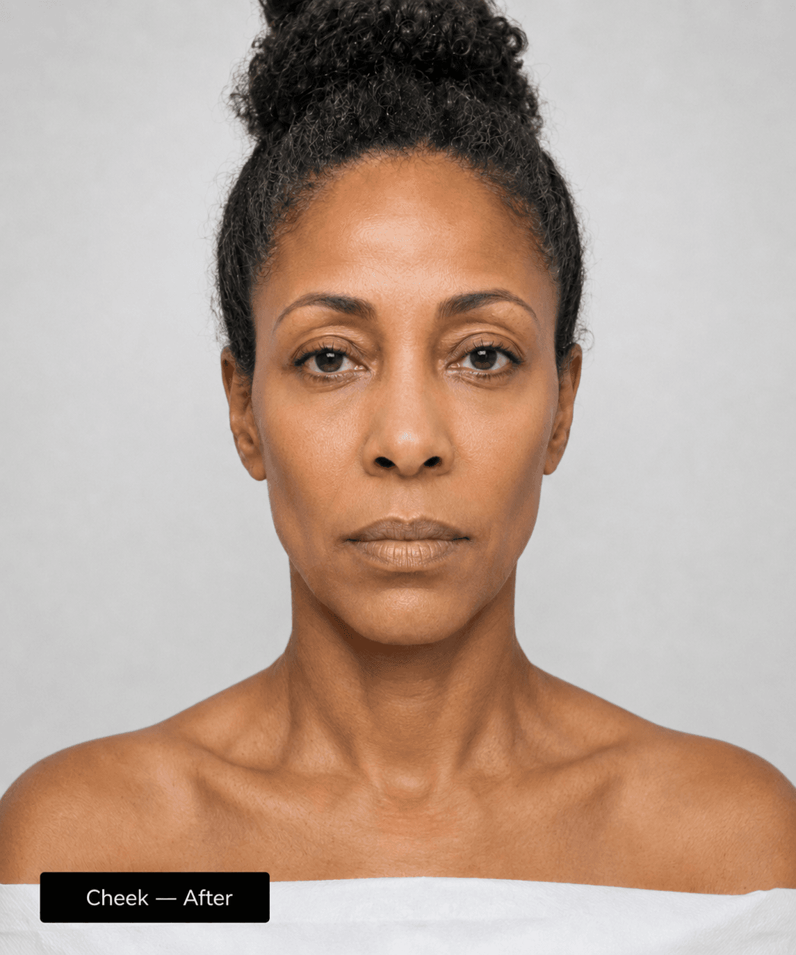 Cheek contour — After