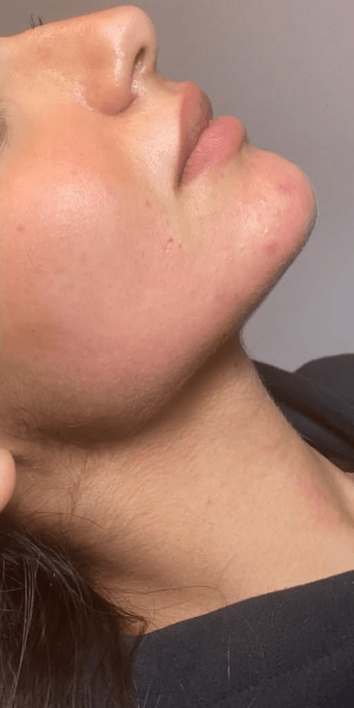Profile Harmony — After